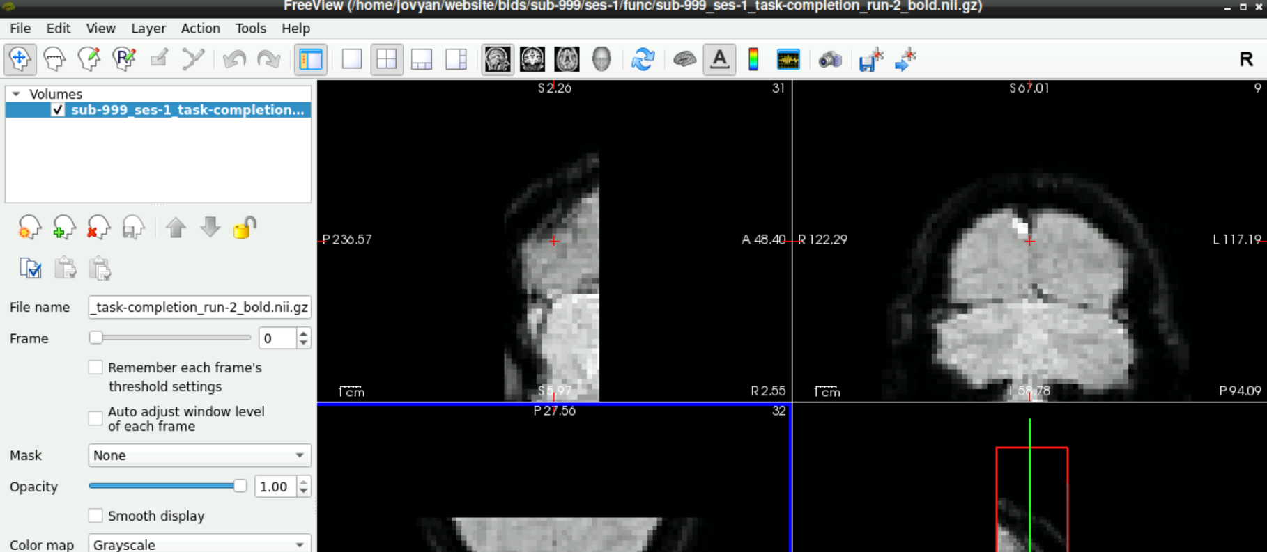 First Frame of Functional Scan