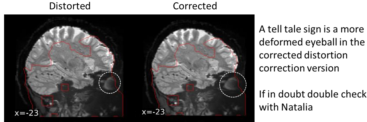 An example of poor distortion correction